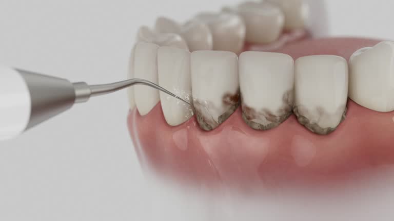 Trusted Teeth Cleaning And Checkup service in Bethany, WV - Dentist Open Now